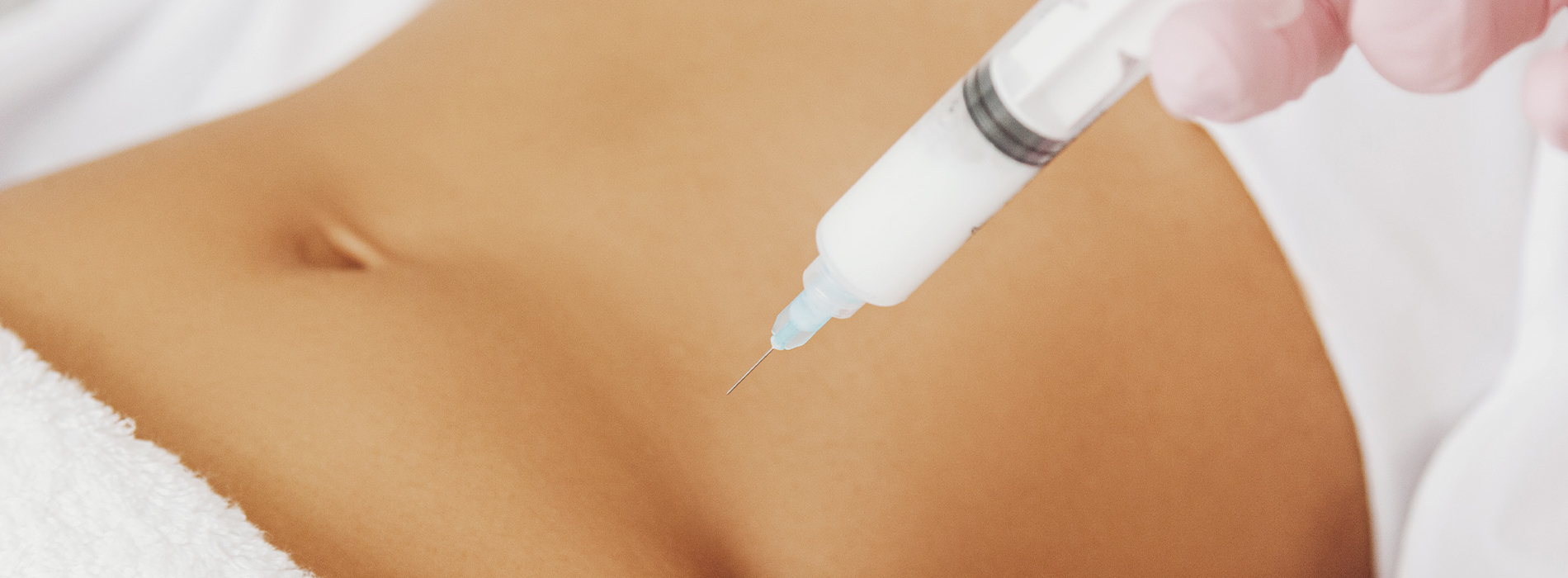 Lipolyse (Fett-Weg-Spritze)